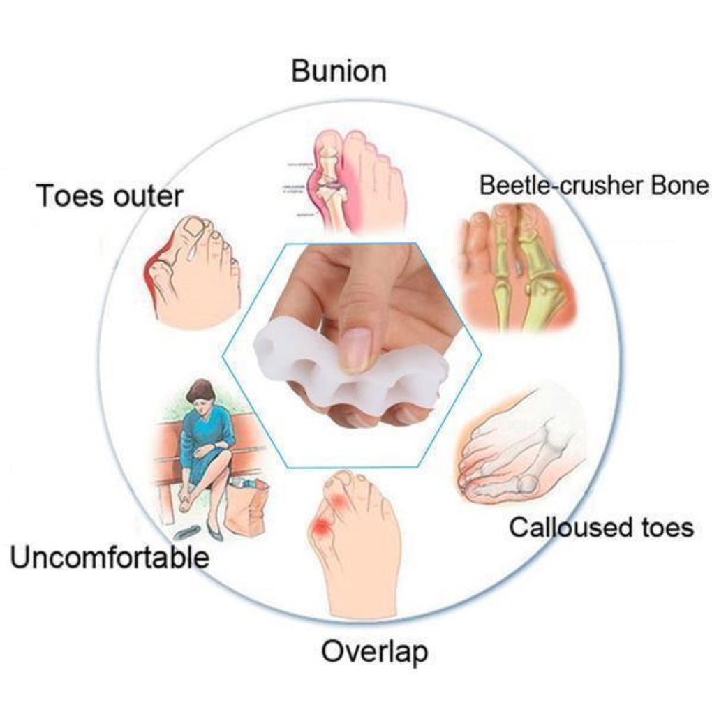 Ontworpen voor Balance Teencorrector - Teenspreider
